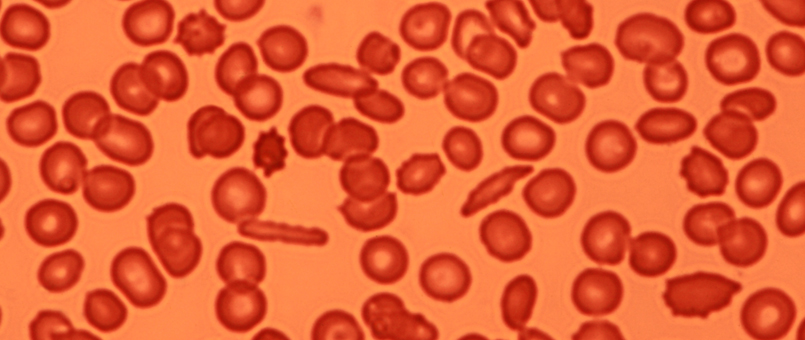 Erythrozyten: Was machen die roten Blutkörperchen?